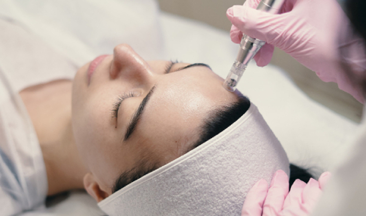 Peeling + Microneedling