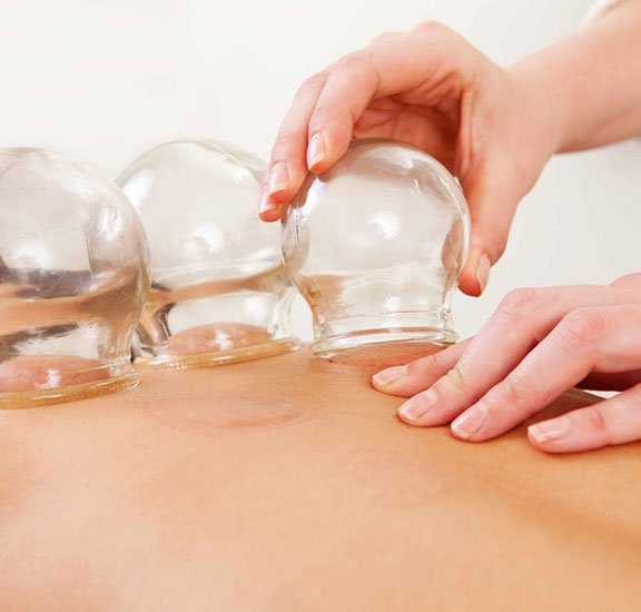 Hijama ou Cupping